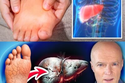 10 Surprising Clues Your Feet Are Telling You About Your Liver Health — What You Need to Know Before It’s Too Late!