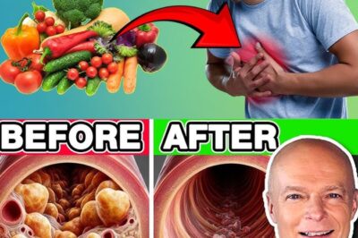 Top 10 Best Vegetables To Unclog Arteries Naturally & Prevent Heart Attack