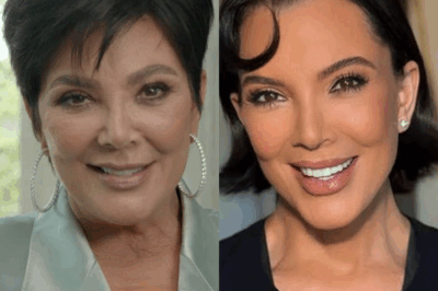 Kris Jenner Finally Breaks Her Silence in the Most Shocking, Unfiltered, and Totally Unexpected Way About Her $150,000 Face Lift, Revealing Every Jaw-Dropping Secret Behind Her Painful Recovery, the Wildest Plastic Surgery Rumors, the Hidden Truth About What Really Happened in That Operating Room, How Her Daughters Reacted, Why the Price Tag Is Even Higher Than Fans Imagined, the Emotional Toll It Took on Her, the Glamorous Return That Left Hollywood Speechless, and the Stunning Confession That Changes Everything We Thought We Knew About the Kardashian Family Matriarch Forever