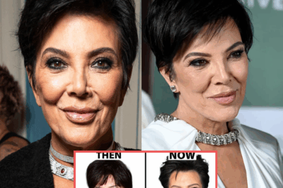 KRIS JENNER RUINED HER FACE? Inside the Shocking Allegations, Secret Procedures, and Hollywood Beauty Obsession That Could Explain How America’s Favorite Momager Went from Glamorous Icon to a Controversial Figure Facing Public Backlash and Endless Speculation About What Really Happened Behind the Scenes of Her Ever-Changing Appearance